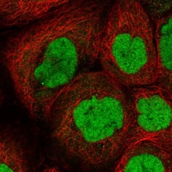 CHD4 Antibody, Novus Biologicals:Antibodies:Primary Antibodies